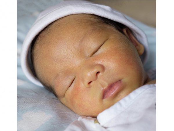 新生児の黄疸を早期検出して治療につなげる画像診断システムを豪とイラクの研究チームが開発 ガジェット通信 Getnews